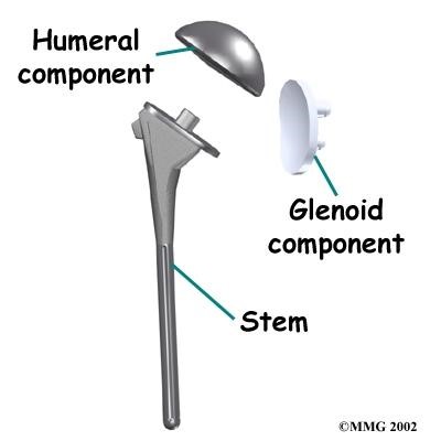 stem