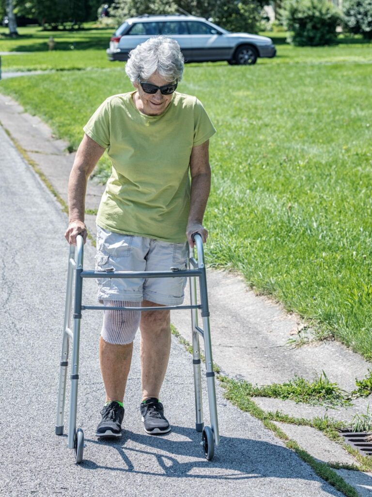 Total Knee Replacement